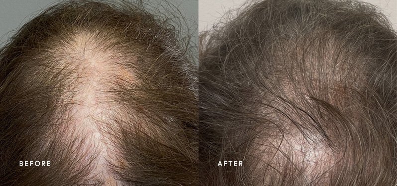 Hair treatment results